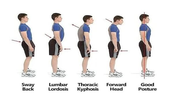 Posture Matters: How to Improve Your Posture and Reduce Pain