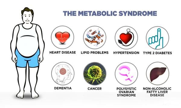 Metabolic Syndrome: The Silent Threat to Your Health