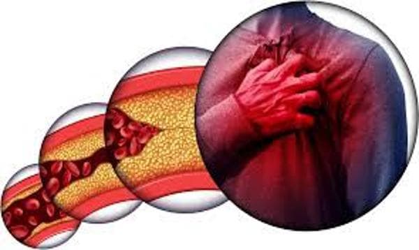 Cholesterol Ratio Calculator – Assess Your Heart Disease Risk