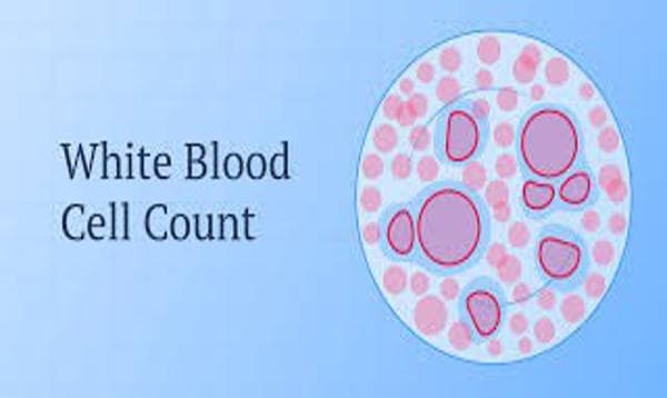 Understanding White Blood Cell Count