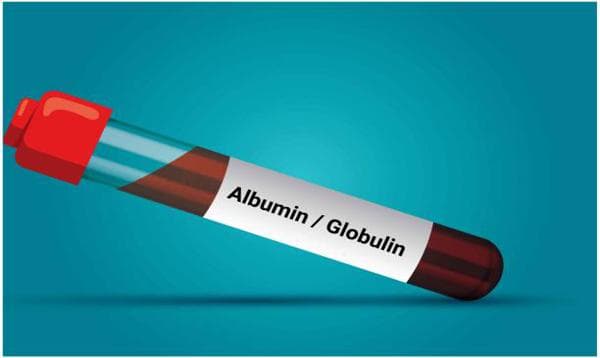 Albumin-to-Globulin Ratio: A Marker of Liver & Immune Health